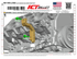 LSX Block - Builders Bracket for Low Mount Universal Accessory Mounting - ICT Billet 551169-LS02